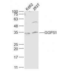 Anti-GGPS1 antibody