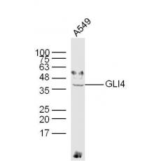 Anti-GLI4 antibody