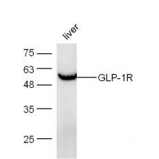 Anti-GLP-1R antibody