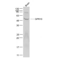 Anti-GPR10 antibody