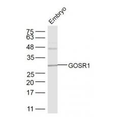 Anti-GOSR1 antibody