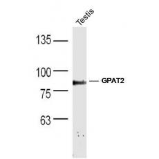 Anti-GPAT2 antibody