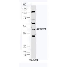 Anti-GPR120 antibody