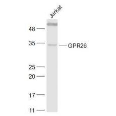 Anti-GPR26 antibody