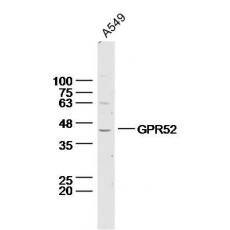 Anti-GPR52 antibody