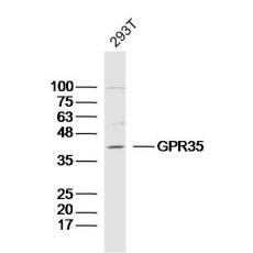 Anti-GPR35 antibody