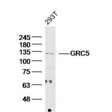 Anti-GRC5 antibody