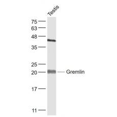 Anti-Gremlin antibody