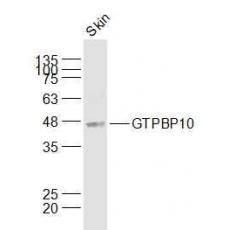 Anti-GTPBP10 antibody