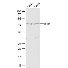 Anti-HFH4 antibody