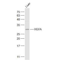 Anti-HGFA antibody