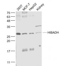 Anti-HIBADH antibody