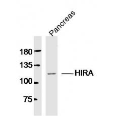 Anti-HIRA antibody