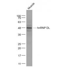 Anti-hnRNP DL antibody