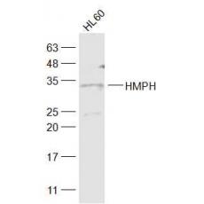 Anti-HMPH antibody