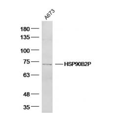 Anti-HSPA12A antibody