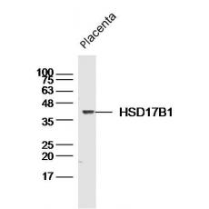 Anti-HSD17B1 antibody
