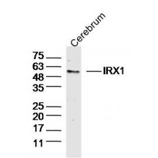 Anti-IRX1 antibody