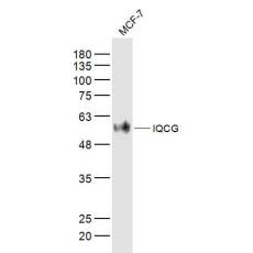 Anti-IQCG antibody