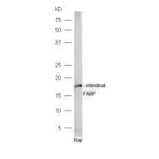 Anti-intestinal FABP antibody