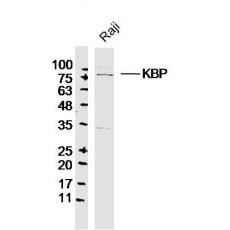 Anti-KBP antibody