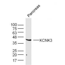 Anti-KCNK3 antibody