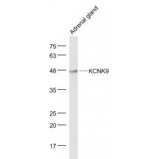 Anti-KCNK9 antibody