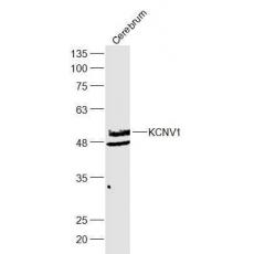 Anti-KCNV1 antibody