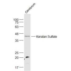 Anti-Keratan Sulfate antibody