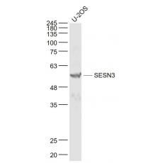 Anti-SESN3 antibody