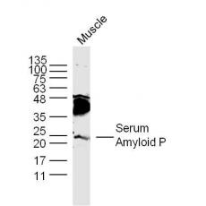 Anti-Serum Amyloid P antibody