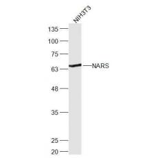 Anti-NARS antibody