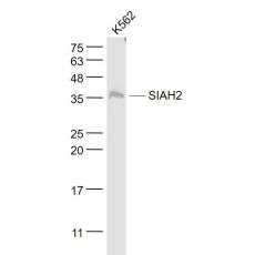 Anti-SH3PX1 antibody