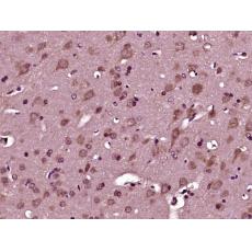 Anti-SEZ6L antibody