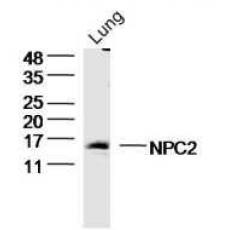 Anti-NPC2 antibody