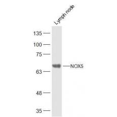 Anti-NOX5 antibody