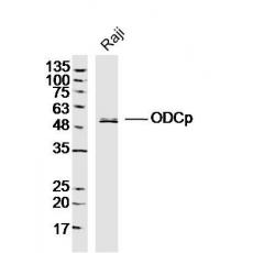 Anti-ODCp antibody