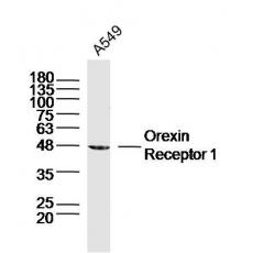 Anti-Orexin Receptor 1 antibody