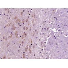 Anti-OTUD6B antibody