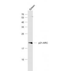 Anti-p21-ARC antibody