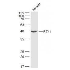 Anti-P2Y1 antibody