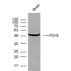 Anti-P2Y9 antibody