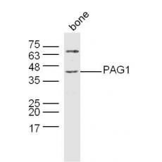 Anti-PAG1 antibody