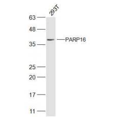 Anti-PARP16 antibody