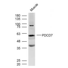 Anti-PDE4D antibody