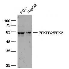 Anti-PFKFB2/PFK2 antibody