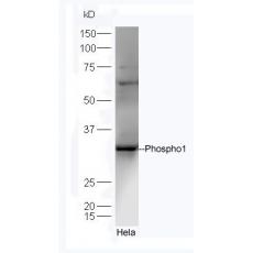 Anti-Phospho1 antibody