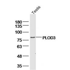 Anti-PLOD3 antibody