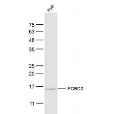 Anti-PCBD2 antibody