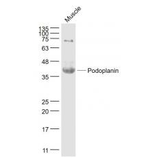 Anti-Podoplanin antibody